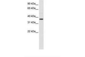 Image no. 1 for anti-alpha-2-HS-Glycoprotein (AHSG) (N-Term) antibody (ABIN6736103)
