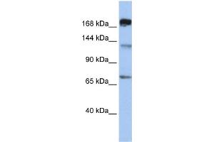 WB Suggested Anti-MTR  Antibody Titration: 0. (MTR 抗体  (C-Term))