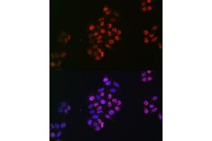 Immunofluorescence (IF) image for anti-SRY (Sex Determining Region Y)-Box 9 (SOX9) antibody (ABIN7270577)