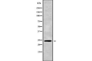 Western blot analysis of APOBEC3H using A549 whole cell lysates (APOBEC3H 抗体  (C-Term))