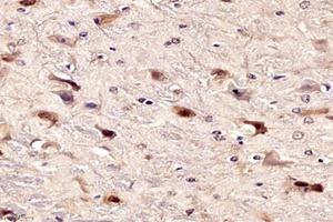 Immunohistochemistry analysis of paraffin-embedded mouse substantia nigra using NPAS1 (ABIN7074820) at dilution of 1: 6000 (NPAS1 抗体)