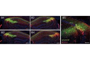 Representative confocal serial sections of mouse hippocampus infected with M1-EGFP (green) and stained with RGS14 ((ABIN1304934), 1:500, red). (RGS14 抗体  (AA 1-544))