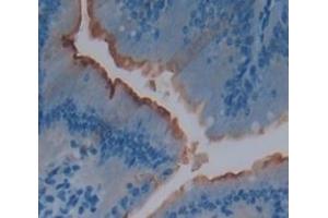 Used in DAB staining on fromalin fixed paraffin- embedded Kidney tissue (IL22R 抗体  (AA 258-552))
