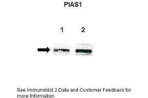 Lanes:   Lane 1: Untreated human U251 lysate Lane 2: IL-1beta treated human U251 lysate  Primary Antibody Dilution:   1:500  Secondary Antibody:   Anti-rabbit-HRP  Secondary Antibody Dilution:   1:500  Gene Name:   PIAS1  Submitted by:   Anonymous (PIAS1 抗体  (Middle Region))