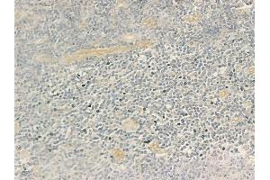 ABIN6258438 and ABIN6274621 at 1/100 staining human normal tonsil tissue by IHC-P.