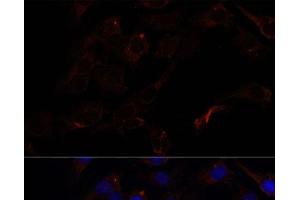 Immunofluorescence analysis of C6 cells using SEPT8 Polyclonal Antibody at dilution of 1:100. (Septin 8 抗体)