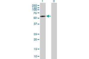 Western Blot analysis of BTBD3 expression in transfected 293T cell line by BTBD3 MaxPab polyclonal antibody. (BTBD3 抗体  (AA 1-522))