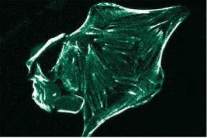 Immunofluorescence staining of HS 766T cells (Human pancreatic carcinoma, ATCC HTB-134). (Ron alpha (AA 40-224) 抗体)