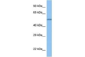 WB Suggested Anti-VANGL1 Antibody Titration: 1. (Vangl1 抗体  (N-Term))
