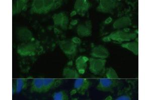 Immunofluorescence analysis of U-2 OS cells using ENO1 Polyclonal Antibody at dilution of 1:100. (ENO1 抗体)