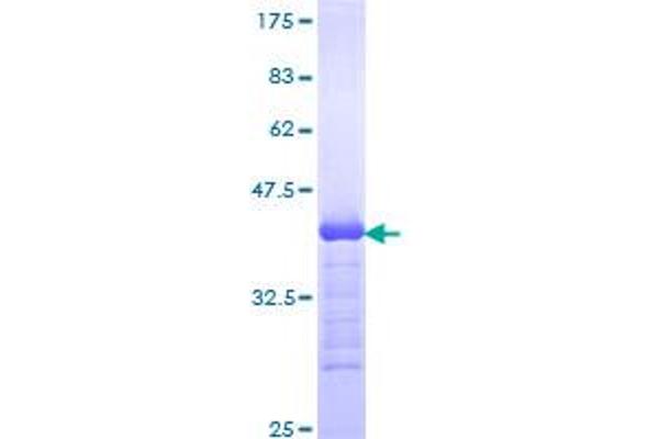 Phospholipase C beta 1 Protein (AA 1107-1216) (GST tag)