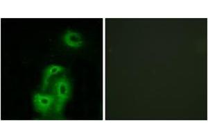 Immunofluorescence analysis of A549 cells, using 5-HT-2A Antibody. (HTR2A 抗体  (AA 422-471))