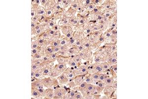 Immunohistochemical analysis of paraffin-embedded H. (STMN2 抗体  (N-Term))