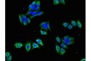 Immunofluorescence (IF) image for anti-Calcium Channel, Voltage-Dependent, beta 4 Subunit (CACNB4) (AA 1-217) antibody (ABIN7175600)