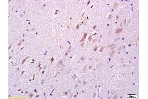 Formalin-fixed and paraffin embedded rat brain labeled with Anti DARPP32 Polyclonal Antibody, Unconjugated (ABIN680323) at 1:200 followed by conjugation to the secondary antibody and DAB staining (DARPP32 抗体  (AA 51-150))