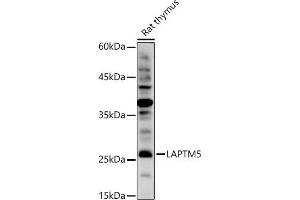 Western blot analysis of extracts of Rat thymus, using L antibody (ABIN7268342) at 1:1000 dilution. (LAPTM5 抗体)