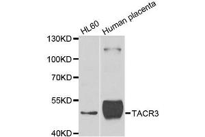 Western blot analysis of extracts of various cell lines, using TACR3 antibody. (TACR3 抗体  (AA 356-465))