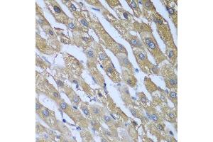 Immunohistochemistry of paraffin-embedded human liver using CAD antibody at dilution of 1:100 (40x lens). (CAD 抗体)