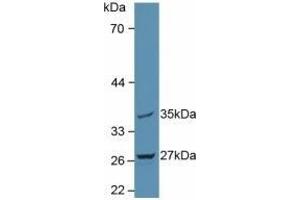 Detection of MTUS1 in Rat Brain Tissue using Polyclonal Antibody to Mitochondrial Tumor Suppressor 1 (MTUS1) (MTUS1 抗体  (AA 1018-1270))