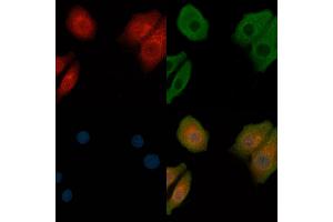 ABIN6257047 and ABIN6273668 staining Hela cells by IF/ICC. (Integrin alpha 1 抗体  (Internal Region))