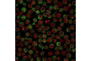 Immunofluorescence Analysis of Raji cells. (CD79a 抗体)