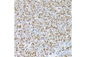 Immunohistochemistry of paraffin-embedded rat ovary using RPS15A Rabbit pAb (ABIN6131092, ABIN6147201, ABIN6147202 and ABIN6214414) at dilution of 1:200 (40x lens). (RPS15A 抗体  (AA 1-130))