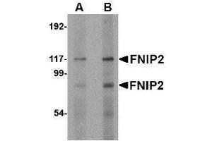 Western blot analysis of FNIP2 in rat skeletal muscle lysate with AP30345PU-N FNIP2 antibody at (A) 1 and (B) 2 μg/ml. (FNIP2 抗体  (C-Term))