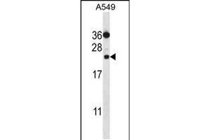 Western blot analysis in A549 cell line lysates (35ug/lane). (PSMD10 抗体  (C-Term))