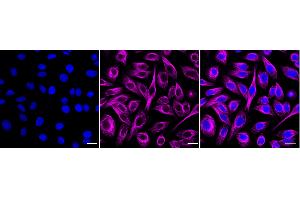 Immunocytochemical staining of HepG2 cells with Pannexin 1 antibody (ABIN7799733), 1:1,000). (Recombinant PANX1 抗体)
