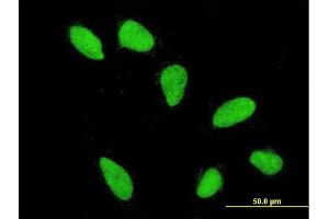 Immunofluorescence of monoclonal antibody to HIST2H2AA3 on HeLa cell. (HIST2H2AA3 抗体  (AA 1-130))