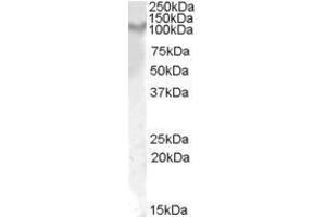 Anti-IL17ra (1µg/ml) staining of Rat Kidney lysate (35µg protein in RIPA buffer). (IL17RA 抗体  (Internal Region))