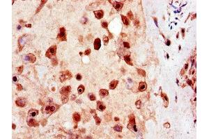 Immunohistochemistry of paraffin-embedded human placenta tissue using ABIN7174296 at dilution of 1:100 (USP25 抗体  (C-Term))