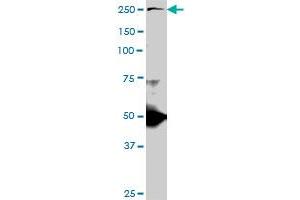 TLN1 monoclonal antibody (M06), clone 2E10. (TLN1 抗体  (AA 1052-1149))