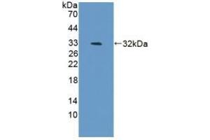 Detection of Recombinant BAFF, Mouse using Polyclonal Antibody to B-Cell Activating Factor (BAFF) (BAFF 抗体  (AA 68-283))
