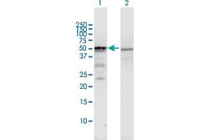 Western Blot analysis of ST13 expression in transfected 293T cell line by ST13 MaxPab polyclonal antibody. (HSC70 Interacting Protein HIP 抗体  (AA 1-369))