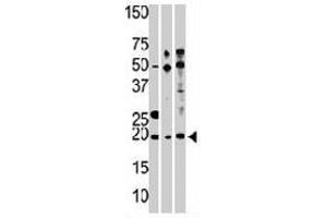 Western blot analysis of RPL23A polyclonal antibody , from left to right, CEM, Hela, and HepG2 cell line lysates (35 ug/lane). (RPL23A 抗体  (C-Term))