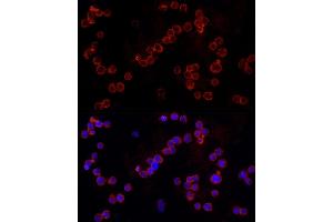 Immunofluorescence analysis of THP-1 cells using NLRC4 Rabbit pAb (ABIN6129418, ABIN6144657, ABIN6144659 and ABIN6223243) at dilution of 1:100 (40x lens). (NLRC4 抗体  (AA 1-250))