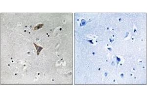 Immunohistochemistry analysis of paraffin-embedded human brain tissue, using KCNT1 Antibody. (KCNT1 抗体  (AA 1019-1068))
