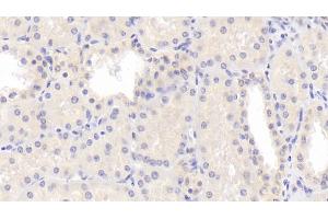 Detection of LPCAT1 in Human Kidney Tissue using Polyclonal Antibody to Lysophosphatidylcholine Acyltransferase 1 (LPCAT1) (LPCAT1 抗体  (AA 70-237))