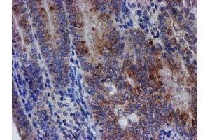 Image no. 6 for anti-Chromosome 21 Open Reading Frame 56 (C21orf56) antibody (ABIN1497041) (C21ORF56 抗体)