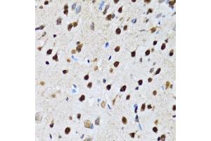 Immunohistochemistry of paraffin-embedded rat brain using CC antibody (ABIN6133528, ABIN6138034, ABIN6138035 and ABIN6222941) at dilution of 1:100 (40x lens). (CCAR2 抗体  (AA 654-923))