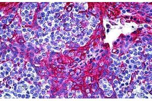 Human Tonsil, Squamous Epithelium: Formalin-Fixed, Paraffin-Embedded (FFPE) (AKR1C4 抗体  (AA 1-324))