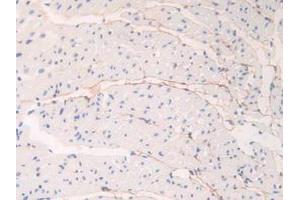IHC-P analysis of Mouse Heart Tissue, with DAB staining. (Fibrillin 1 抗体  (AA 1701-1887))