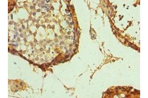 Immunohistochemistry (IHC) image for anti-GATA Binding Protein 3 (GATA3) (AA 1-260) antibody (ABIN7172390)