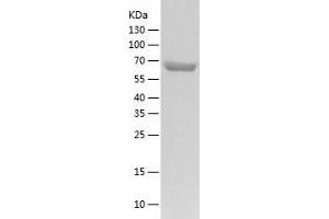 Western Blotting (WB) image for Ubiquilin 2 (UBQLN2) (AA 1-624) protein (His tag) (ABIN7125571) (Ubiquilin 2 Protein (UBQLN2) (AA 1-624) (His tag))