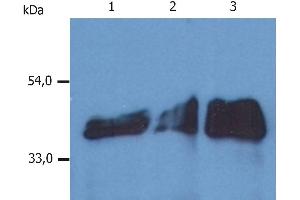 Western Blotting analysis (reducing conditions) of whole cell lysate using anti-human Cytokeratin 18 (DA-7). (Cytokeratin 18 抗体  (Biotin))
