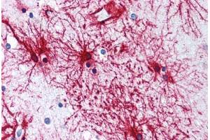 Human Brain, Cortex, Astrocytes (formalin-fixed, paraffin-embedded) stained with GFAP antibody ABIN305893 at 5 ug/ml followed by biotinylated anti-goat IgG secondary antibody ABIN481715, alkaline phosphatase-streptavidin and chromogen. (GFAP 抗体  (AA 417-430))