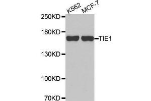 Western blot analysis of extracts of various cell lines, using TIE1 antibody. (TIE1 抗体  (AA 350-600))