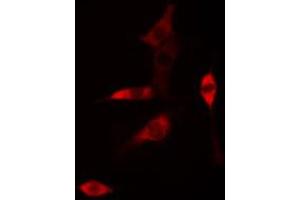 ABIN6268761 staining HUVEC cells by IF/ICC. (Claudin 6 抗体  (Internal Region))