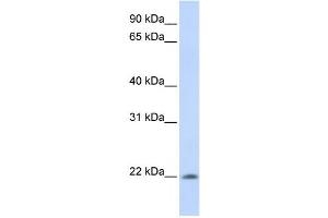 Western Blotting (WB) image for anti-All-Trans Retinoic Acid-Induced Differentiation Factor (ATRAID) antibody (ABIN2457891) (ATRAID 抗体)